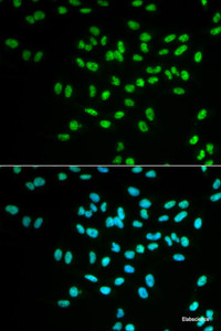 Immunofluorescence analysis of MCF-7 cells using FANCD2 Polyclonal Antibody