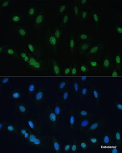 Immunofluorescence analysis of U-2 OS cells using Histone H2AX Polyclonal Antibody at dilution of 1:100 (40x lens) . Blue: DAPI for nuclear staining.