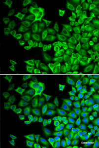 Immunofluorescence analysis of A549 cells using HCK Polyclonal Antibody