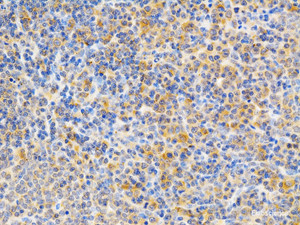 Immunohistochemistry of paraffin-embedded Rat spleen using PRKCE Polyclonal Antibody at dilution of 1:200 (40x lens) .