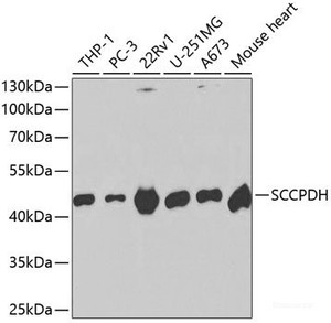 Western blot analysis of extracts of various cell lines using SCCPDH Polyclonal Antibody at dilution of 1:1000.