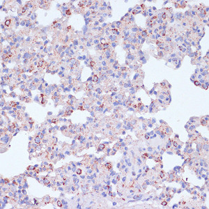 Immunohistochemistry of paraffin-embedded Rat lung using CD18 Polyclonal Antibody at dilution of 1:100 (40x lens) .