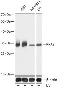 Western blot analysis of extracts of various cell lines using RPA2 Polyclonal Antibody at dilution of 1:1000. 293T cells were treated by UV at room tempeRature for 15-30 minutes.