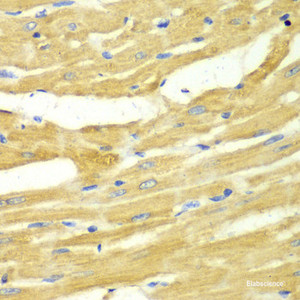 Immunohistochemistry of paraffin-embedded Rat heart using OGT Polyclonal Antibody at dilution of 1:100 (40x lens) .