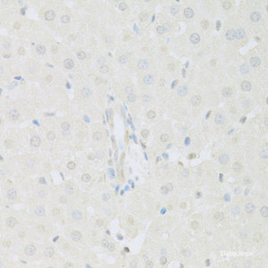 Immunohistochemistry of paraffin-embedded Rat liver using KAT2A Polyclonal Antibody at dilution of 1:100 (40x lens) .