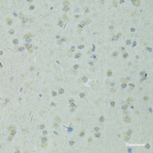 Immunohistochemistry of paraffin-embedded Rat brain using TRIM28 Polyclonal Antibody at dilution of 1:100 (40x lens) .