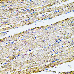 Immunohistochemistry of paraffin-embedded Rat heart using FLNB Polyclonal Antibody at dilution of 1:100 (40x lens) .