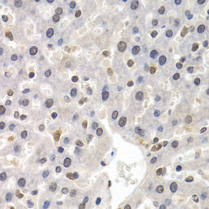 Immunohistochemistry of paraffin-embedded Rat liver using GTF2F1 Polyclonal Antibody at dilution of 1:200 (40x lens) .
