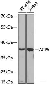 Western blot analysis of extracts of various cell lines using ACP5 Polyclonal Antibody at dilution of 1:200.