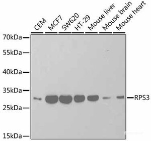 Western blot analysis of extracts of various cell lines using RPS3 Polyclonal Antibody at dilution of 1:1000.