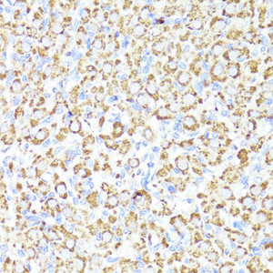 Immunohistochemistry of paraffin-embedded Rat ovary using CYP3A4 Polyclonal Antibody at dilution of 1:100 (40x lens) .