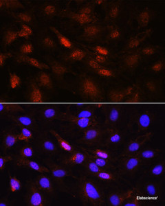 Immunofluorescence analysis of C6 cells using PLK1 Polyclonal Antibody at dilution of 1:100 (40x lens) . Blue: DAPI for nuclear staining.