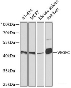 Western blot analysis of extracts of various cell lines using VEGFC Polyclonal Antibody at dilution of 1:500.