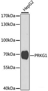 Western blot analysis of extracts of HepG2 cells using PRKG1 Polyclonal Antibody at dilution of 1:1000.