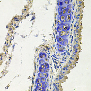 Immunohistochemistry of paraffin-embedded Mouse lung using SKP1 Polyclonal Antibody at dilution of 1:100 (40x lens) .