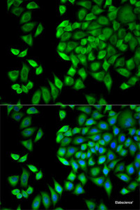 Immunofluorescence analysis of HeLa cells using WNK1 Polyclonal Antibody