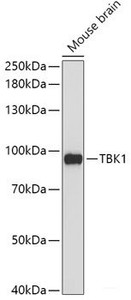 Western blot analysis of extracts of Mouse brain using TBK1 Polyclonal Antibody at dilution of 1:1000.
