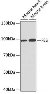 Western blot analysis of extracts of various cell lines using FES Polyclonal Antibody at dilution of 1:1000.