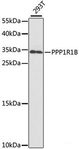 Western blot analysis of extracts of 293T cells using PPP1R1B Polyclonal Antibody at dilution of 1:1000.