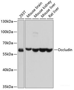 Western blot analysis of extracts of various cell lines using Occludin Polyclonal Antibody at dilution of 1:1000.