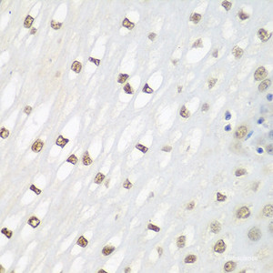 Immunohistochemistry of paraffin-embedded Human esophagus using FOSL2 Polyclonal Antibody at dilution of 1:100 (40x lens) .