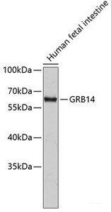 Western blot analysis of extracts of Human fetal intestine using GRB14 Polyclonal Antibody.