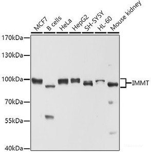 Western blot analysis of extracts of various cell lines using IMMT Polyclonal Antibody at dilution of 1:1000.