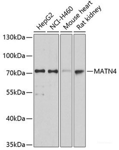 Western blot analysis of extracts of various cell lines using MATN4 Polyclonal Antibody at dilution of 1:3000.