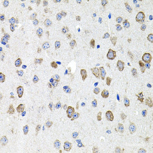 Immunohistochemistry of paraffin-embedded Mouse brain using CDH23 Polyclonal Antibody at dilution of 1:100 (40x lens) .