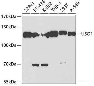 Western blot analysis of extracts of various cell lines using USO1 Polyclonal Antibody at dilution of 1:500.