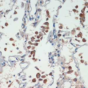 Immunohistochemistry of paraffin-embedded Human lung using APC Polyclonal Antibody at dilution of 1:200 (40x lens) .