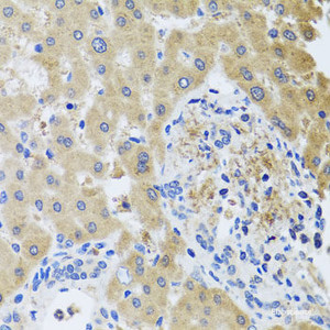 Immunohistochemistry of paraffin-embedded Human liver damage using RHOB Polyclonal Antibody at dilution of 1:100 (40x lens) .