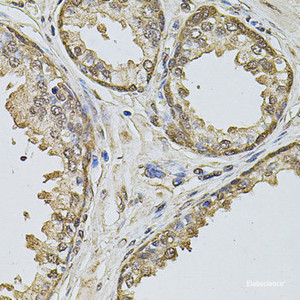 Immunohistochemistry of paraffin-embedded Human prostate using Cyclin A2 Polyclonal Antibody at dilution of 1:100 (40x lens) .