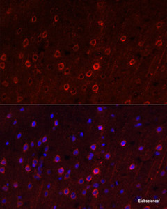 Immunofluorescence analysis of Rat brain using SLC1A1 Polyclonal Antibody at dilution of 1:100. Blue: DAPI for nuclear staining.