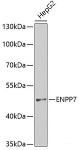Western blot analysis of extracts of HepG2 cells using ENPP7 Polyclonal Antibody at dilution of 1:400.