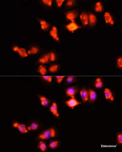Immunofluorescence analysis of HeLa cells using HOXA11 Polyclonal Antibody at dilution of 1:100 (40x lens) . Blue: DAPI for nuclear staining.