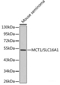 Western blot analysis of extracts of Mouse seminoma using MCT1/SLC16A1 Polyclonal Antibody.