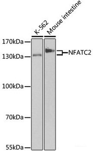 Western blot analysis of extracts of various cell lines using NFATC2 Polyclonal Antibody at dilution of 1:500.