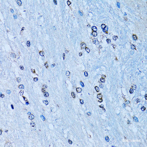 Immunohistochemistry of paraffin-embedded Rat brain using NFkB p100 / p52 Polyclonal Antibody at dilution of 1:100 (40x lens) .