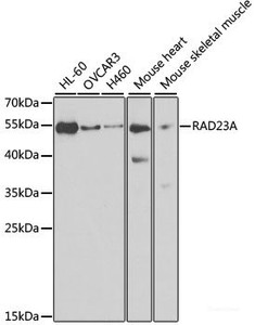 Western blot analysis of extracts of various cell lines using RAD23A Polyclonal Antibody at dilution of 1:1000.