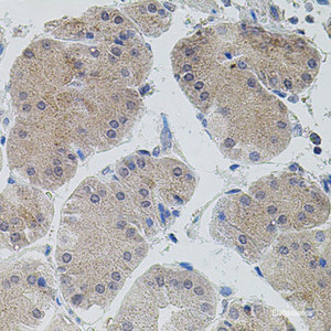 Immunohistochemistry of paraffin-embedded Human stomach using ASK1 Polyclonal Antibody