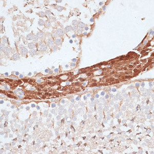 Immunohistochemistry of paraffin-embedded Rat testis using KIFC1 Polyclonal Antibody at dilution of 1:100 (40x lens) .