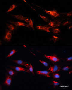 Immunofluorescence analysis of C6 cells using MAP1B Polyclonal Antibody at dilution of 1:100. Blue: DAPI for nuclear staining.