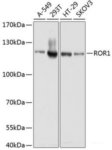 Western blot analysis of extracts of various cell lines using ROR1 Polyclonal Antibody at dilution of 1:1000.