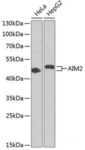 Western blot analysis of extracts of various cell lines using AIM2 Polyclonal Antibody at dilution of 1:1000.