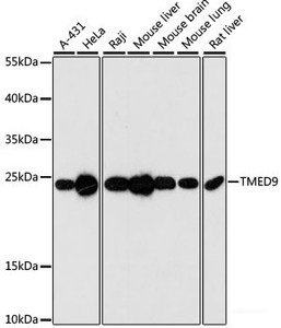 Western blot analysis of extracts of various cell lines using TMED9 Polyclonal Antibody at dilution of 1:3000.
