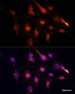 Immunofluorescence analysis of C6 cells using NSUN2 Polyclonal Antibody at dilution of 1:100. Blue: DAPI for nuclear staining.