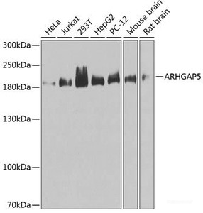 Western blot analysis of extracts of various cell lines using ARHGAP5 Polyclonal Antibody at dilution of 1:1000.