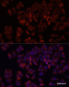 Immunofluorescence analysis of HeLa cells using ARF5 Polyclonal Antibody at dilution of 1:100. Blue: DAPI for nuclear staining.