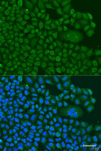 Immunofluorescence analysis of U2OS cells using BBS4 Polyclonal Antibody at dilution of 1:100. Blue: DAPI for nuclear staining.